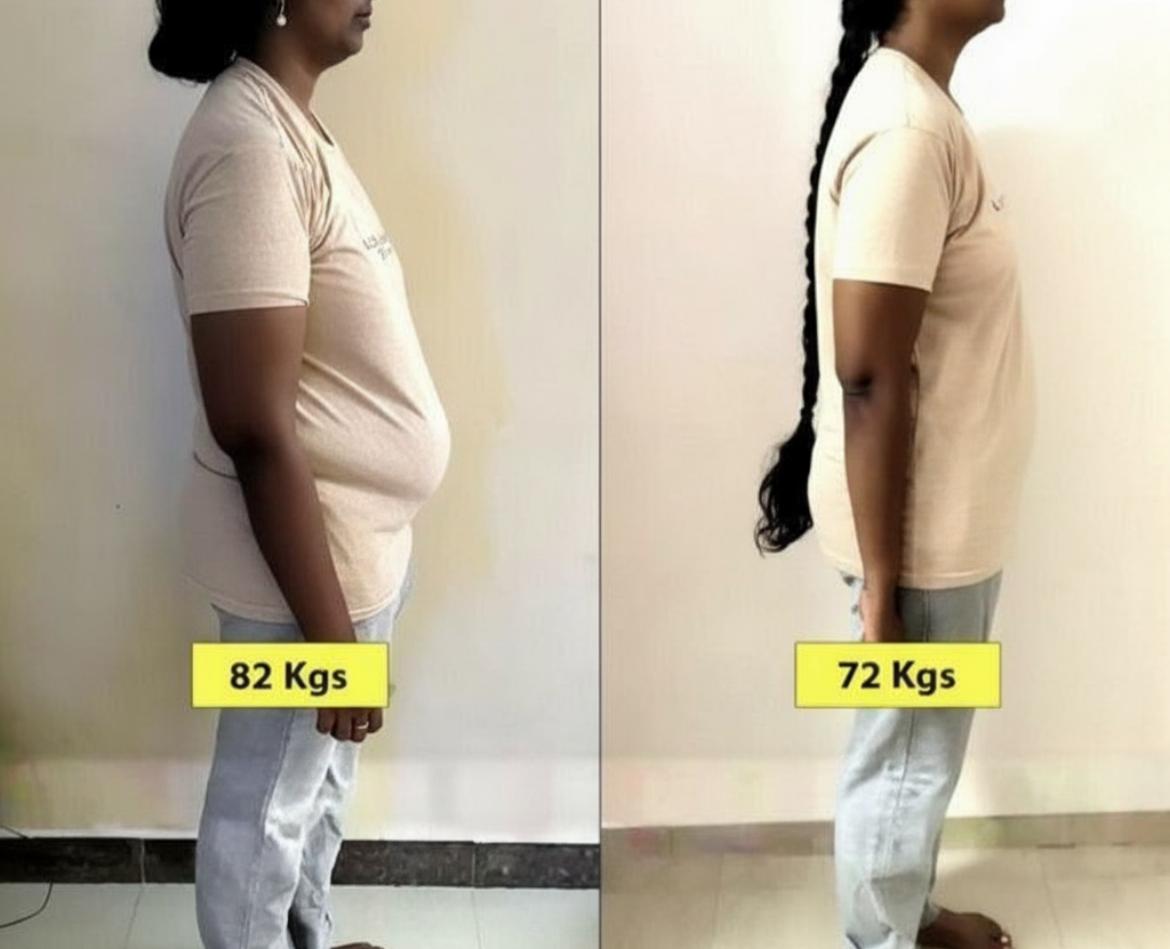 Client transformation: 82 kg → 72 kg (side)
